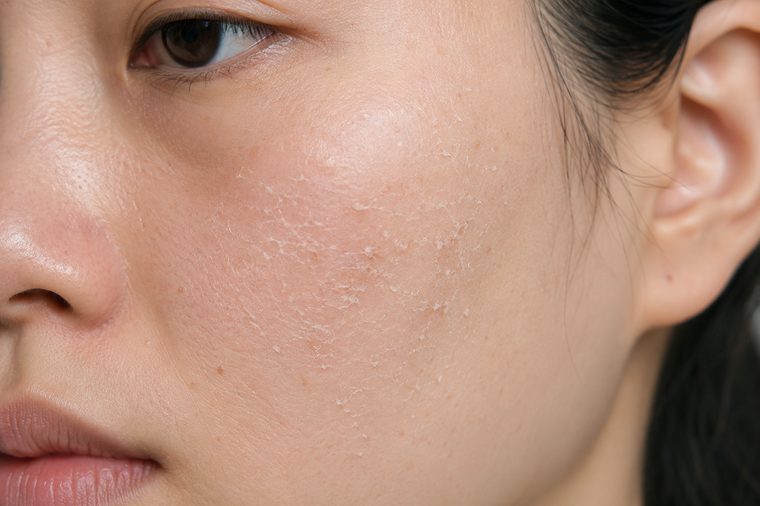 洗后紧绷干燥